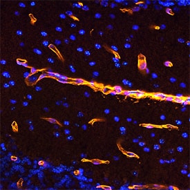 Netrin-4 was detected in perfusion fixed frozen sections of mouse brain (nucleus accumbens) using Goat Anti-Mouse Netrin-4 Antigen Affinity-purified Polyclonal Antibody (Catalog # AF1132) conjugated to Digoxigenin at 15 µg/mL overnight at 4 °C. Tissue was stained using 25 µg/mL Mouse Anti-Digoxigenin Monoclonal Antibody (Catalog # MAB7520) followed by incubation with NorthernLights™ 557-conjugated Anti-Mouse IgG Secondary Antibody (yellow; Catalog # NL007). Tissue was counter-stained with DAPI (blue). Specific staining was localized to vasculature. View our protocol for Fluorescent IHC Staining of Frozen Tissue Sections.