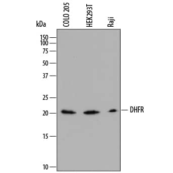 Western blot shows lysates of COLO 205 human colorectal adenocarcinoma cell line, HEK293T human embryonic kidney cell line, and Raji human Burkitt's lymphoma cell line. PVDF membrane was probed with 0.5 µg/mL of Sheep Anti-Human Dihydrofolate Reductase/DHFR Antigen Affinity-purified Polyclonal Antibody (Catalog # AF7934) followed by HRP-conjugated Anti-Sheep IgG Secondary Antibody (Catalog # HAF016). A specific band was detected for Dihydrofolate Reductase/DHFR at approximately 21 kDa (as indicated). This experiment was conducted under reducing conditions and using Immunoblot Buffer Group 1.