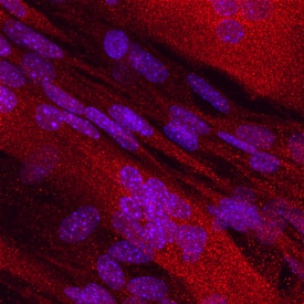 Dihydrofolate Reductase/DHFR was detected in immersion fixed C2C12 mouse myoblast cell line using Mouse Anti-Human Dihydrofolate Reductase/DHFR Monoclonal Antibody (Catalog # MAB7934) at 10 µg/mL for 3 hours at room temperature. Cells were stained using the NorthernLights™ 557-conjugated Anti-Mouse IgG Secondary Antibody (red; Catalog # NL007) and counterstained with DAPI (blue). Specific staining was localized to cytoplasm. View our protocol for Fluorescent ICC Staining of Cells on Coverslips.