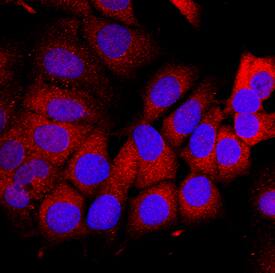 Dihydrofolate Reductase/DHFR was detected in immersion fixed MCF-7 human breast cancer cell line using Mouse Anti-Human Dihydrofolate Reductase/DHFR Monoclonal Antibody (Catalog # MAB7934) at 10 µg/mL for 3 hours at room temperature. Cells were stained using the NorthernLights™ 557-conjugated Anti-Mouse IgG Secondary Antibody (red; Catalog # NL007) and counterstained with DAPI (blue). Specific staining was localized to the cytoplasm. View our protocol for Fluorescent ICC Staining of Cells on Coverslips.