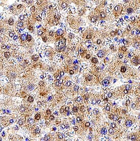 Dihydrolipoamide Dehydrogenase/DLD was detected in immersion fixed paraffin-embedded sections of human liver tissue using Mouse Anti-Human Dihydrolipoamide Dehydrogenase/DLD Monoclonal Antibody (Catalog # MAB8646) at 5 µg/mL for 1 hour at room temperature followed by incubation with the Anti-Mouse IgG VisUCyte™ HRP Polymer Antibody (Catalog # VC001). Before incubation with the primary antibody, tissue was subjected to heat-induced epitope retrieval using Antigen Retrieval Reagent-Basic (Catalog # CTS013). Tissue was stained using DAB (brown) and counterstained with hematoxylin (blue). Specific staining was localized to cytoplasm and nuclei in hepatocytes. View our protocol for IHC Staining with VisUCyte HRP Polymer Detection Reagents.