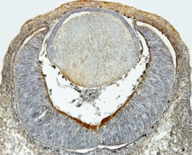 Immunohistochemistry Dkk-1 Antibody