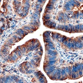 Dkk-1 was detected in immersion fixed paraffin-embedded sections of human colon using Human Dkk-1 Monoclonal Antibody (Catalog # MAB10962) at 15 µg/mL overnight at 4 °C. Before incubation with the primary antibody, tissue was subjected to heat-induced epitope retrieval using Antigen Retrieval Reagent-Basic (Catalog # CTS013). Tissue was stained using the Anti-Mouse HRP-DAB Cell & Tissue Staining Kit (brown; Catalog # CTS002). Specific staining was localized to epithelial cells. View our protocol for Chromogenic IHC Staining of Paraffin-embedded Tissue Sections.