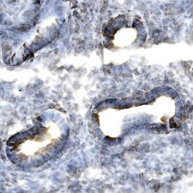Dkk‑1 was detected in immersion fixed frozen sections of mouse embryo (15 d.p.c) using Mouse Dkk‑1 Monoclonal Antibody (Catalog # MAB1765) at 25 &micro;g/mL overnight at 4 &deg;C. Tissue was stained using the Anti-Rat HRP-DAB Cell & Tissue Staining Kit (brown; Catalog # CTS017) and counterstained with hematoxylin (blue). Specific labeling was localized to the cytoplasm of epithelial cells in lung. View our protocol for Chromogenic IHC Staining of Frozen Tissue Sections.