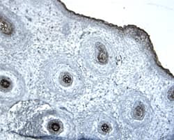 Immunohistochemistry Dkk-2 Antibody