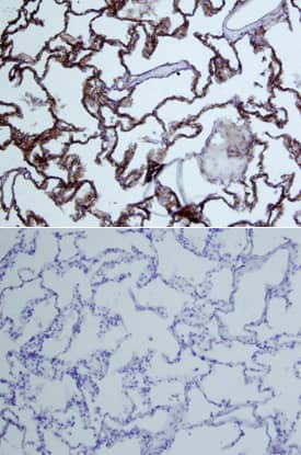 Dkk-3 was detected in immersion fixed paraffin-embedded sections of human lung array using Goat Anti-Human Dkk-3 Biotinylated Antigen Affinity-purified Polyclonal Antibody (Catalog # BAF1118) at 15 µg/mL overnight at 4 °C. Tissue was stained using the Anti-Goat HRP-DAB Cell & Tissue Staining Kit (brown; CTS008) and counterstained with hematoxylin (blue). Lower panel shows a lack of labeling if primary antibodies are omitted and tissue is stained only with secondary antibody followed by incubation with detection reagents. View our protocol for Chromogenic IHC Staining of Paraffin-embedded Tissue Sections.