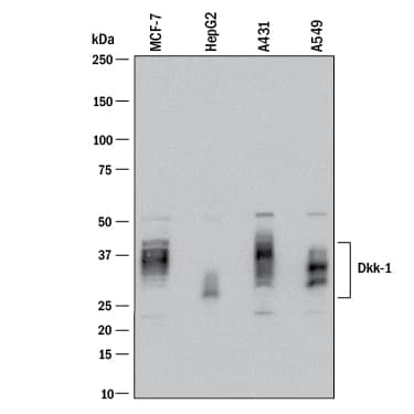 Western Blot Dkk-1 Antibody [Unconjugated]