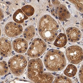 Immunohistochemistry Dkk-2 Antibody (994930) [Unconjugated]
