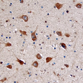 Immunohistochemistry Doc2-alpha Antibody (842213)