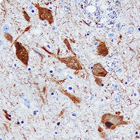 Immunohistochemistry Dopa Decarboxylase/DDC Antibody [Unconjugated]
