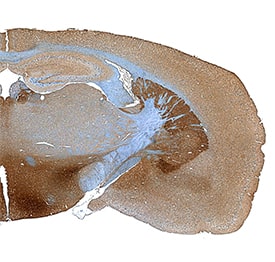 Immunohistochemistry Dopa Decarboxylase/DDC Antibody [Unconjugated]