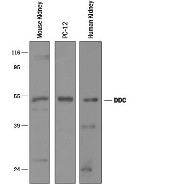 Western blot shows lysates of mouse kidney tissue, PC-12 rat adrenal pheochromocytoma cell line, and human kidney tissue. PVDF membrane was probed with 1 µg/mL of Goat Anti-Human/Mouse/Rat Dopa Decarboxylase/DDC Antigen Affinity-purified Polyclonal Antibody (Catalog # AF3564) followed by HRP-conjugated Anti-Goat IgG Secondary Antibody (Catalog # HAF109). A specific band was detected for Dopa Decarboxylase/DDC at approximately 54 kDa (as indicated). This experiment was conducted under reducing conditions and using Immunoblot Buffer Group 1.