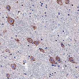 Dopamine D2 R/DRD2 was detected in immersion fixed paraffin-embedded sections of human brain (striatum) using Mouse Anti-Human Dopamine D2 R/DRD2 Monoclonal Antibody (Catalog # MAB9266) at 5 µg/mL for 1 hour at room temperature followed by incubation with the Anti-Mouse IgG VisUCyte™ HRP Polymer Antibody (Catalog # VC001). Tissue was stained using DAB (brown) and counterstained with hematoxylin (blue). Specific staining was localized to neuronal cell membranes and cytoplasm. View our protocol for Chromogenic IHC Staining of Paraffin-embedded Tissue Sections.