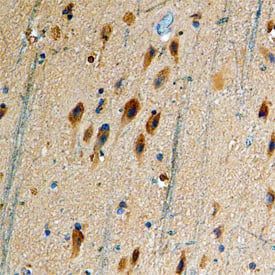 Immunohistochemistry Dopamine D5R/DRD5 Antibody (889040)
