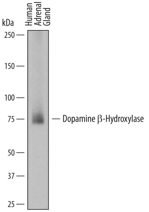 Western blot shows lysates of human adrenal gland tissue. PVDF membrane was probed with 2 µg/mL of Sheep Anti-Human Dopamine  beta -Hydroxylase Antigen Affinity-purified Polyclonal Antibody (Catalog # AF7376) followed by HRP-conjugated Anti-Sheep IgG Secondary Antibody (Catalog # HAF016). A specific band was detected for Dopamine  beta -Hydroxylase at approximately 74-77 kDa (as indicated). This experiment was conducted under reducing conditions and using Immunoblot Buffer Group 1.