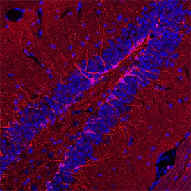 Doublecortin/DCX was detected in perfusion fixed frozen sections of mouse brain (hippocampus) using Sheep Anti-Human/Mouse Doublecortin/DCX Antigen Affinity-purified Polyclonal Antibody (Catalog # AF10025) at 8 µg/mL overnight at 4 °C. Tissue was stained using the NorthernLights™ 557-conjugated Anti-Sheep IgG Secondary Antibody (red; Catalog # NL010) and counterstained with DAPI (blue). Specific staining was localized to cytoplasm in neurons. View our protocol for Chromogenic IHC Staining of Frozen Tissue Sections.