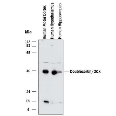 Western blot shows lysates of human motor cortex tissue, human hypothalamus tissue, and human hippocampus tissue. PVDF membrane was probed with 1 µg/mL of Sheep Anti-Human/Mouse Doublecortin/DCX Antigen Affinity-purified Polyclonal Antibody (Catalog # AF10025) followed by HRP-conjugated Anti-Sheep IgG Secondary Antibody (Catalog # HAF016). A specific band was detected for Doublecortin/DCX at approximately 40 kDa (as indicated). This experiment was conducted under reducing conditions and using Immunoblot Buffer Group 1.