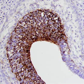 Draxin was detected in immersion fixed frozen sections of mouse embryo (E13) using Mouse Draxin Antigen Affinity-purified Polyclonal Antibody (Catalog # AF6149) at 5 µg/mL overnight at 4 °C. Tissue was stained using the Anti-Sheep HRP-DAB Cell & Tissue Staining Kit (brown; Catalog # <a class=