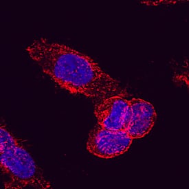 Drebrin 1 was detected in immersion fixed HeLa human cervical epithelial carcinoma cell line using Mouse Anti-Human Drebrin 1 Monoclonal Antibody (Catalog # MAB7739) at 25 µg/mL for 3 hours at room temperature. Cells were stained using the Northern-Lights™ 557-conjugated Anti-Mouse IgG Secondary Antibody (red; Catalog # NL007) and counterstained with DAPI (blue). Specific staining was localized to cell membrane and cytoplasm. View our protocol for Fluorescent ICC Staining of Cells on Coverslips.