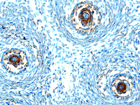Immunohistochemistry Dtk/TYRO3 Antibody [Unconjugated]