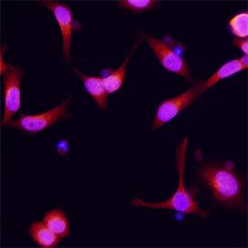 Dynactin Subunit 2/DCTN2 was detected in immersion fixed HeLa human cervical epithelial carcinoma cell line using Sheep Anti-Human Dynactin Subunit 2/DCTN2 Antigen Affinity-purified Polyclonal Antibody (Catalog # AF6850) at 15 µg/mL for 3 hours at room temperature. Cells were stained using the NorthernLights™ 557-conjugated Anti-Sheep IgG Secondary Antibody (red; Catalog # NL010) and counterstained with DAPI (blue). Specific staining was localized to cytoplasm. View our protocol for Fluorescent ICC Staining of Cells on Coverslips.