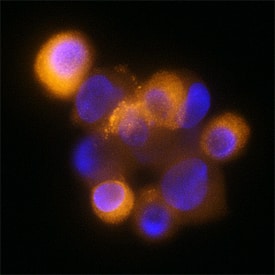 Dynactin Subunit 2/DCTN2 was detected in immersion fixed HeLa human cervical epithelial carcinoma cell line using Mouse Anti-Human Dynactin Subunit 2/DCTN2 Monoclonal Antibody (Catalog # MAB6850) at 25 µg/mL for 3 hours at room temperature. Cells were stained using the NorthernLights™ 557-conjugated Anti-Mouse IgG Secondary Antibody (red; Catalog # NL007) and counterstained with DAPI (blue. Specific staining was localized to cytoplasm. View our protocol for Fluorescent ICC Staining of Cells on Coverslips.