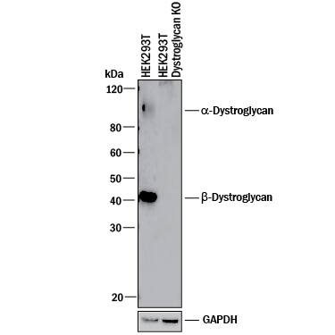 Western blot shows lysates of HEK293T human embryonic kidney parental cell line and Dystroglycan knockout HEK293T cell line (KO). PVDF membrane was probed with 1 µg/mL of Sheep Anti-Human Dystroglycan Antigen Affinity-purified Polyclonal Antibody (Catalog # AF6868) followed by HRP-conjugated Anti-Sheep IgG Secondary Antibody (Catalog # HAF016). Specific bands were detected for a--Dystroglycan at approximately 110 kDa -and  beta -Dystroglycan at approximately 42 kDa (as indicated) in the parental HEK293T cell line, but is not detectable in knockout HEK293T cell line. GAPDH (Catalog # AF5718) is shown as a loading control. This experiment was conducted under reducing conditions and using Immunoblot Buffer Group 1.