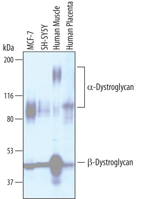 Western Blot Dystroglycan Antibody [Unconjugated]