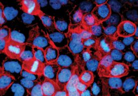 E-Cadherin was detected in immersion fixed human epidermoid carcinoma cells using 10 µg/mL Goat Anti-Human/Mouse E-Cadherin Antigen Affinity-purified Polyclonal Antibody (Catalog # AF648) for 3 hours at room temperature. Cells were stained with the NorthernLights™ 557-conjugated Anti-Goat IgG Secondary Antibody (red; Catalog # NL001) and counterstained with DAPI (blue). View our protocol for Fluorescent ICC Staining of Cells on Coverslips.