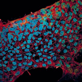 E-Cadherin and SOX2 were detected in BG01V human embryonic stem cells using 10 µg/mL Goat Anti-Human/Mouse E-Cadherin Antigen Affinity-purified Polyclonal Antibody (Catalog # AF648) and 10 µg/mL Human/Mouse SOX2 Monoclonal Antibody (Catalog # MAB2018). Cells were incubated with primary antibodies for 3 hours at room temperature. Cells were stained for E-Cadherin using the NorthernLights™ 557-conjugated Anti-Goat IgG Secondary Antibody (green; Catalog # NL001) and for SOX2 using the NorthernLights 493-conjugated Anti-Mouse Secondary Antibody (red; Catalog # NL009). Cells were counterstained with DAPI (blue). View our protocol for Fluorescent ICC Staining of Cells on Coverslips.