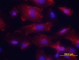 E-Selectin/CD62E was detected in immersion fixed HUVEC human umbilical vein endothelial cells activated with TNF-a (Catalog # 210-TA-010) using Mouse Anti-Human E-Selectin/ CD62E Monoclonal Antibody (Catalog # BBA16) at 10 µg/mL for 3 hours at room temperature. Cells were stained using the NorthernLights™ 557-conjugated Anti-Mouse IgG Secondary Antibody (red; Catalog # NL007) and counterstained with DAPI (blue). View our protocol for Fluorescent ICC Staining of Cells on Coverslips.