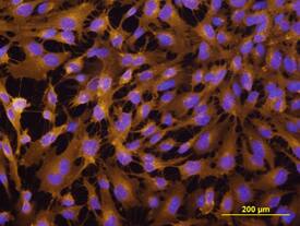 E-Selectin/CD62E was detected in immersion fixed human umbilical vein endothelial cells (HUVECs) activated with TNF alpha using Mouse Anti-Human E-Selectin/CD62E Biotinylated Monoclonal Antibody (Catalog # BBA8) at 10 µg/mL for 3 hours at room temperature. Cells were stained using the NorthernLights™ 557-conjugated Anti-Mouse IgG Secondary Antibody (yellow; Catalog # NL007) and counterstained with DAPI (blue). View our protocol for Fluorescent ICC Staining of Cells on Coverslips.