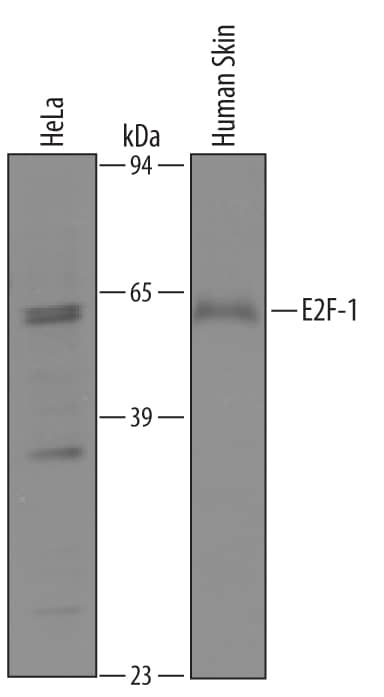Western blot shows lysates of HeLa human cervical epithelial carcinoma cell line and human skin tissue. PVDF membrane was probed with 1 µg/mL of Sheep Anti-Human E2F-1 Antigen Affinity-purified Polyclonal Antibody (Catalog # AF4825) followed by HRP-conjugated Anti-Sheep IgG Secondary Antibody (Catalog # HAF016). A specific band was detected for E2F-1 at approximately 60 kDa (as indicated). This experiment was conducted under reducing conditions and using Immunoblot Buffer Group 8.