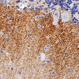 EAAT1/GLAST-1 was detected in immersion fixed paraffin-embedded sections of human brain (cerebellum) tissue using Mouse Anti-Human EAAT1/GLAST-1 Monoclonal Antibody (Catalog # MAB6048) at 5 µg/mL for 1 hour at room temperature followed by incubation with the Anti-Mouse IgG VisUCyte™ HRP Polymer Antibody (Catalog # VC001). Before incubation with the primary antibody, tissue was subjected to heat-induced epitope retrieval using Antigen Retrieval Reagent-Basic (Catalog # CTS013). Tissue was stained using DAB (brown) and counterstained with hematoxylin (blue). Specific staining was localized to neuronal puncta in molecular layer . View our protocol for IHC Staining with VisUCyte HRP Polymer Detection Reagents.