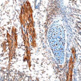 Immunohistochemistry EBF-2 Antibody [Unconjugated]