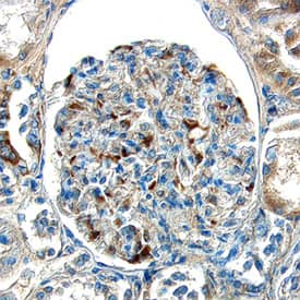 Immunohistochemistry ECE-1 Antibody