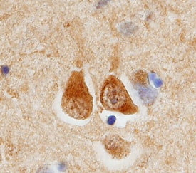 Immunohistochemistry ECE-2 Antibody (233914) [Unconjugated]