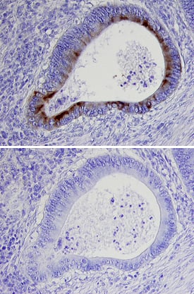 Immunohistochemistry ECM-1/Secretory Component P85 Antibody [Unconjugated]