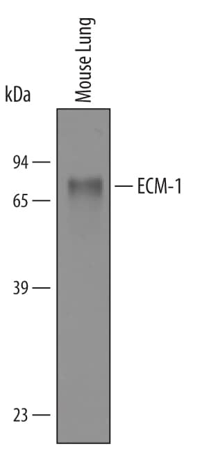Western Blot ECM-1/Secretory Component P85 Antibody