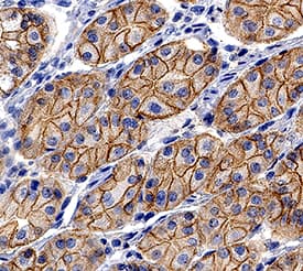 E-Cadherin was detected in immersion fixed paraffin-embedded sections of human stomach using Goat Anti-Human/Mouse E-Cadherin Antigen Affinity-purified Polyclonal Antibody (Catalog # AF648) at 0.3 µg/mL for 1 hour at room temperature followed by incubation with the Anti-Goat IgG VisUCyte™ HRP Polymer Antibody (Catalog # VC004). Tissue was stained using DAB (brown) and counterstained with hematoxylin (blue). Specific staining was localized to cell membrane and cytoplasm in gastric glands. View our protocol for IHC Staining with VisUCyte HRP Polymer Detection Reagents.