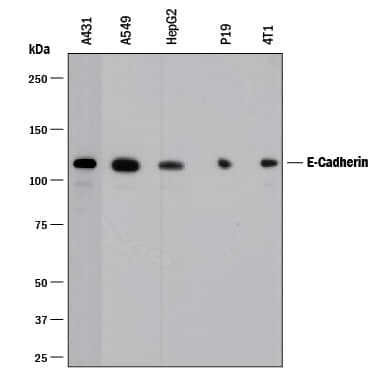 Western blot shows lysates of A431 human epithelial carcinoma cell line, A549 human lung carcinoma cell line, HepG2 human hepatocellular carcinoma cell line, P19 mouse embryonal carcinoma cell line, and 4T1 mouse breast cancer cell line. PVDF membrane was probed with 0.5 µg/mL of Goat Anti-Human/Mouse E-Cadherin Antigen Affinity-purified Polyclonal Antibody (Catalog # AF648) followed by HRP-conjugated Anti-Goat IgG Secondary Antibody (Catalog # HAF017). A specific band was detected for E-Cadherin at approximately 110 kDa (as indicated). This experiment was conducted under reducing conditions and using Immunoblot Buffer Group 1.