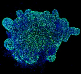 Immunocytochemistry E-Cadherin Antibody [Unconjugated]
