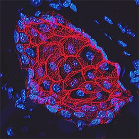 E-Cadherin was detected in perfusion fixed frozen sections of mouse skin using Goat Anti-Human/Mouse E-Cadherin Antigen Affinity-purified Polyclonal Antibody (Catalog # AF748) at 1.7 µg/mL overnight at 4 °C. Tissue was stained using the NorthernLights™ 557-conjugated Anti-Goat IgG Secondary Antibody (red; Catalog # NL001) and counterstained with DAPI (blue). Specific staining was localized to plasma membranes in keratinocytes. View our protocol for Fluorescent IHC Staining of Frozen Tissue Sections.