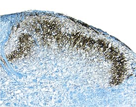 E-Cadherin was detected in perfusion fixed frozen sections of mouse spinal cord using Goat Anti-Human/Mouse E-Cadherin Antigen Affinity-purified Polyclonal Antibody (Catalog # AF748) at 1.7 µg/mL overnight at 4 °C. Tissue was stained using the Anti-Goat HRP-DAB Cell & Tissue Staining Kit (brown; Catalog # CTS008) and counterstained with hematoxylin (blue). Specific staining was localized to dorsal horn. View our protocol for Chromogenic IHC Staining of Frozen Tissue Sections.
