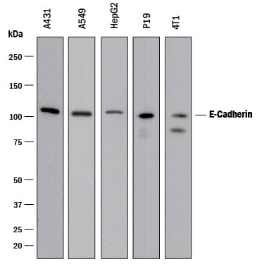 Western Blot E-Cadherin Antibody [Unconjugated]