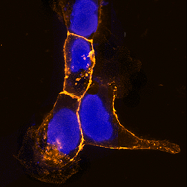 E-Cadherin was detected in immersion fixed A431 human skin epidermal cell line using Goat Anti-Mouse E-Cadherin Biotinylated Antigen Affinity-purified Polyclonal Antibody (Catalog # BAF748) at 5 µg/mL for 3 hours at room temperature. Cells were stained using the NorthernLights™ 557-conjugated Streptavidin (yellow; Catalog # NL999) and counterstained with DAPI (blue). Specific staining was localized to plasma membranes. View our protocol for Fluorescent ICC Staining of Cells on Coverslips.