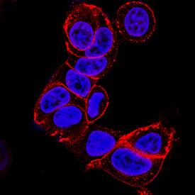 E-Cadherin was detected in immersion fixed MCF-7 human breast cancer cell line using Mouse Anti-Human E-Cadherin Monoclonal Antibody (Catalog # MAB18381) at 3 µg/mL for 3 hours at room temperature. Cells were stained using the NorthernLights™ 557-conjugated Anti-Mouse IgG Secondary Antibody (red; Catalog # NL007) and counterstained with DAPI (blue). Specific staining was localized to cell membrane. View our protocol for Fluorescent ICC Staining of Cells on Coverslips.
