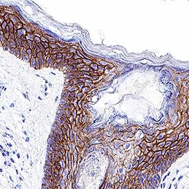 E-Cadherin was detected in immersion fixed paraffin-embedded sections of human skin using Mouse Anti-Human E-Cadherin Monoclonal Antibody (Catalog # MAB18381) at 0.5 µg/mL for 1 hour at room temperature followed by incubation with the Anti-Mouse IgG VisUCyte™ HRP Polymer Antibody (Catalog # VC001). Tissue was stained using DAB (brown) and counterstained with hematoxylin (blue). Specific staining was localized to plasma membrane. View our protocol for Chromogenic IHC Staining of Paraffin-embedded Tissue Sections.