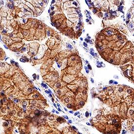 E-Cadherin was detected in immersion fixed paraffin-embedded sections of human stomach using Mouse Anti-Human E-Cadherin Monoclonal Antibody (Catalog # MAB18381) at 5 µg/mL for 1 hour at room temperature followed by incubation with the Anti-Mouse IgG VisUCyte™ HRP Polymer Antibody (Catalog # VC001). Tissue was stained using DAB (brown) and counterstained with hematoxylin (blue). Specific staining was localized to plasma membrane. View our protocol for Chromogenic IHC Staining of Paraffin-embedded Tissue Sections.