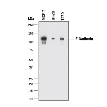 Western blot shows lysates of MCF-7 human breast cancer cell line, BT-20 human breast cancer cell line, and T47D human breast cancer cell line. PVDF membrane was probed with 2 µg/mL of Mouse Anti-Human E-Cadherin Monoclonal Antibody (Catalog # MAB18381) followed by HRP-conjugated Anti-Mouse IgG Secondary Antibody (Catalog # HAF018). A specific band was detected for E-Cadherin at approximately 120 kDa (as indicated). This experiment was conducted under reducing conditions and using Immunoblot Buffer Group 1.